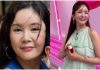 “I Grew Up Glamorous!” Jang Young-ran Plastic Surgery Glow-Up Stuns Fans Jang Young-ran Plastic Surgery