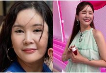 “I Grew Up Glamorous!” Jang Young-ran Plastic Surgery Glow-Up Stuns Fans Jang Young-ran Plastic Surgery