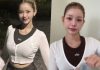 Maeng Seung-ji Plastic Surgery Update: Philtrum Surgery Results Maeng Seung-ji Plastic Surgery Update