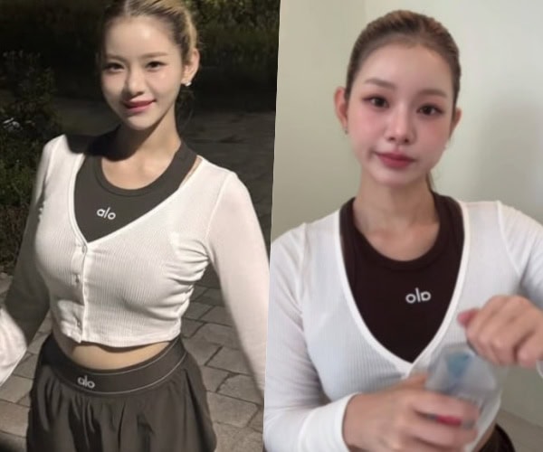 Maeng Seung-ji Plastic Surgery Update
